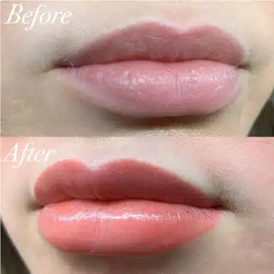 LIP